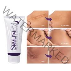 SNMLPM 흉터제거연고 수술 화상 상처 여드름흉터 개선, 50ml