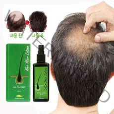 1+1 최적의 포뮬라 탈모에 효과적 탈모치료 탈모 병원 두피케어 탈모트리트먼트, 120ml