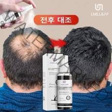 1+1 최적의 포뮬러 탈모 방지 효과의 탈모 영양제 두피 에센스 발모제, 100ml*2