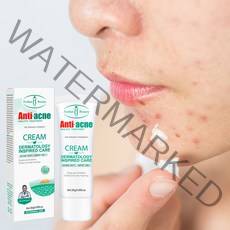 (국내출하) aichun 1+1 여드름 색소침착 좁쌀여드름 여드름 방지 미백 연고, 20g, 1개